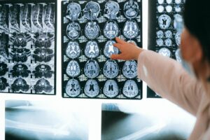 causes of traumatic brain injury